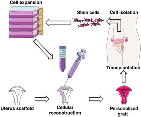 metal uterus fabrication|Bioengineering of the Uterus .